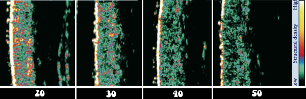 Skin scan results