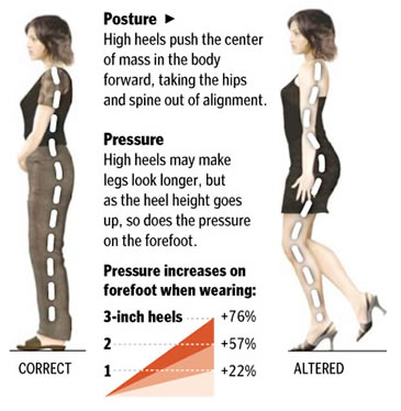 High heel posture problems